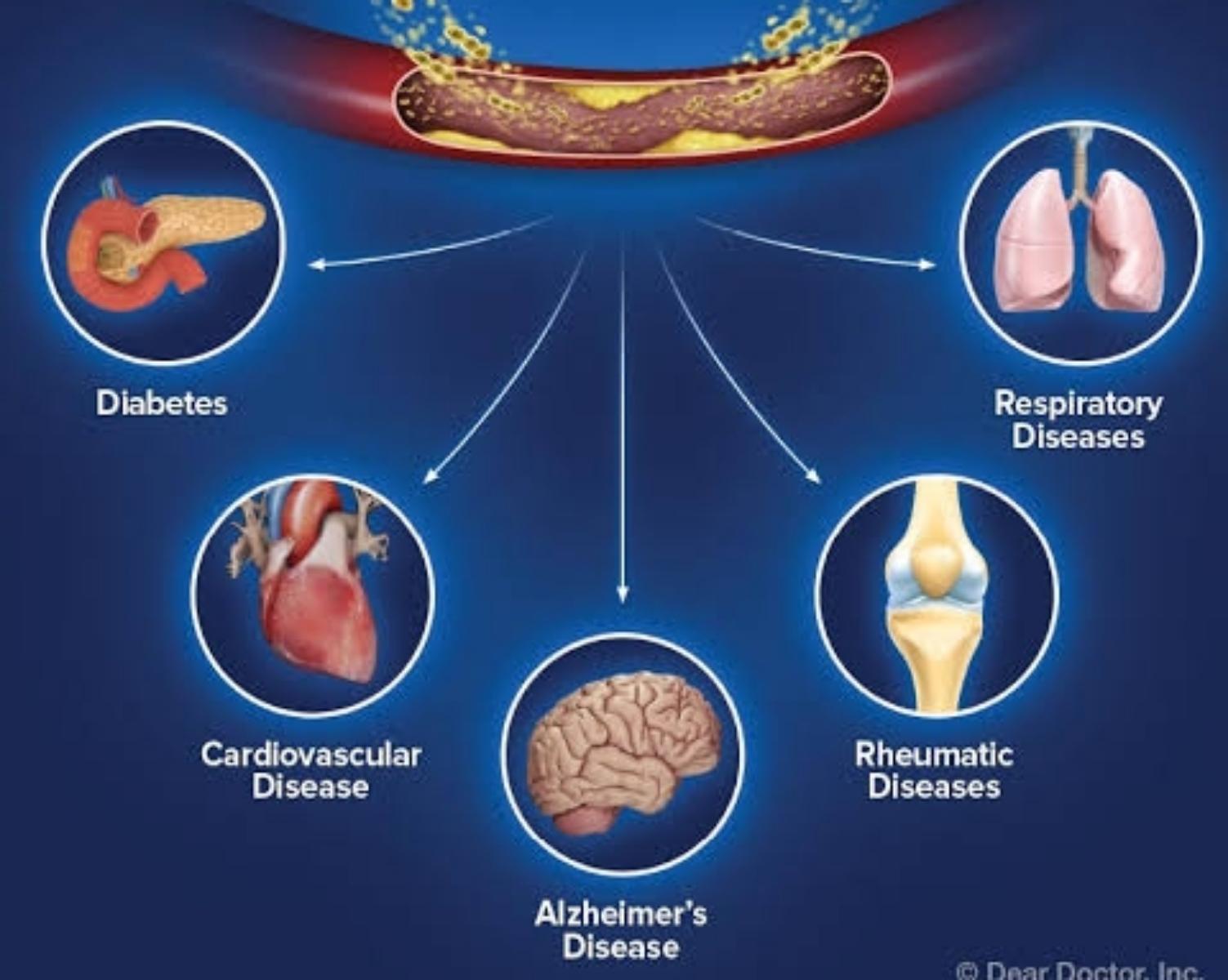 Myth 10: Gum disease is only a concern for your mouth