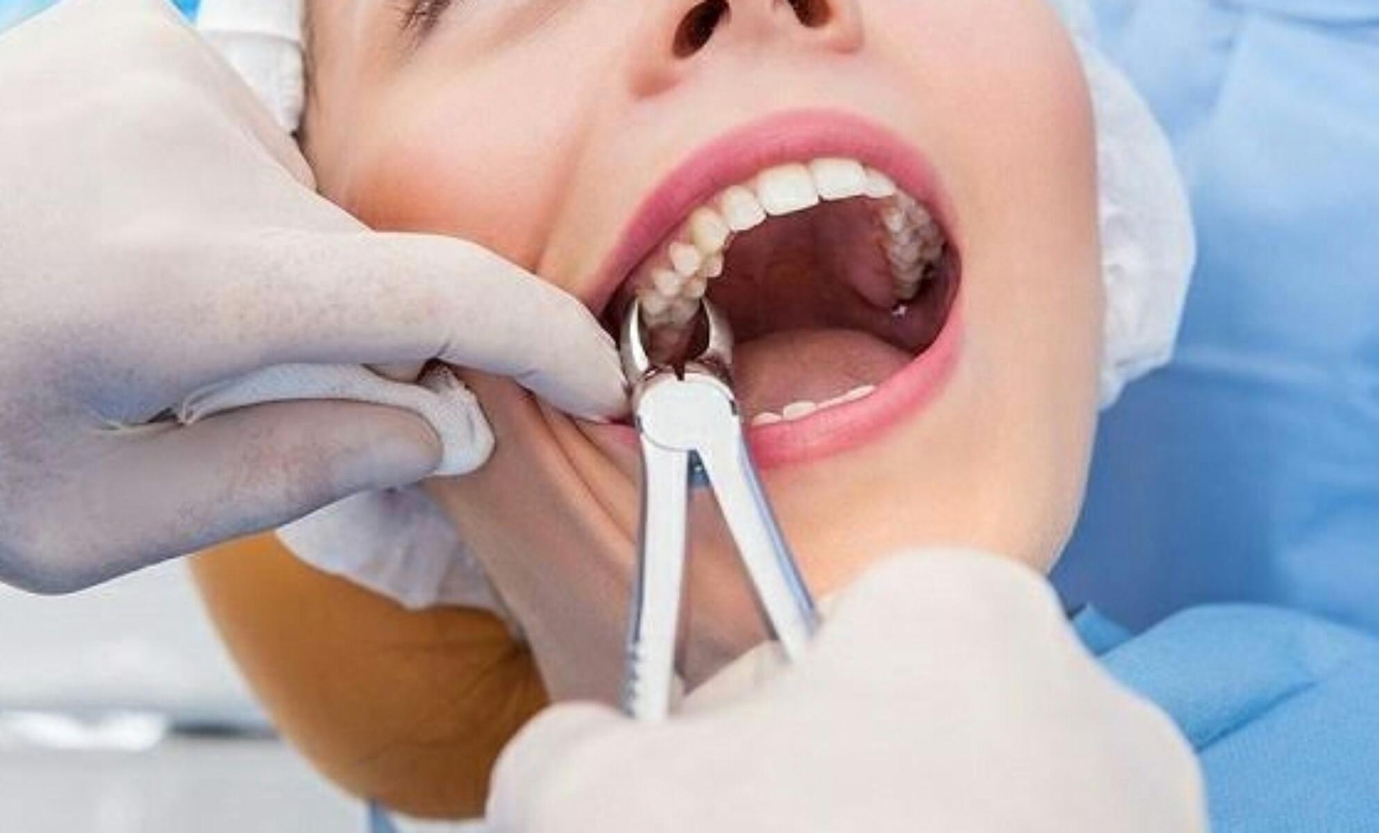 A little wisdom on wisdom teeth