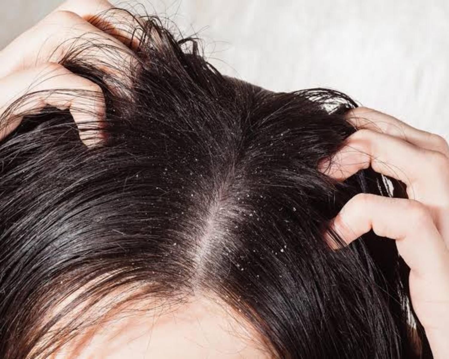 Oilier Hair
