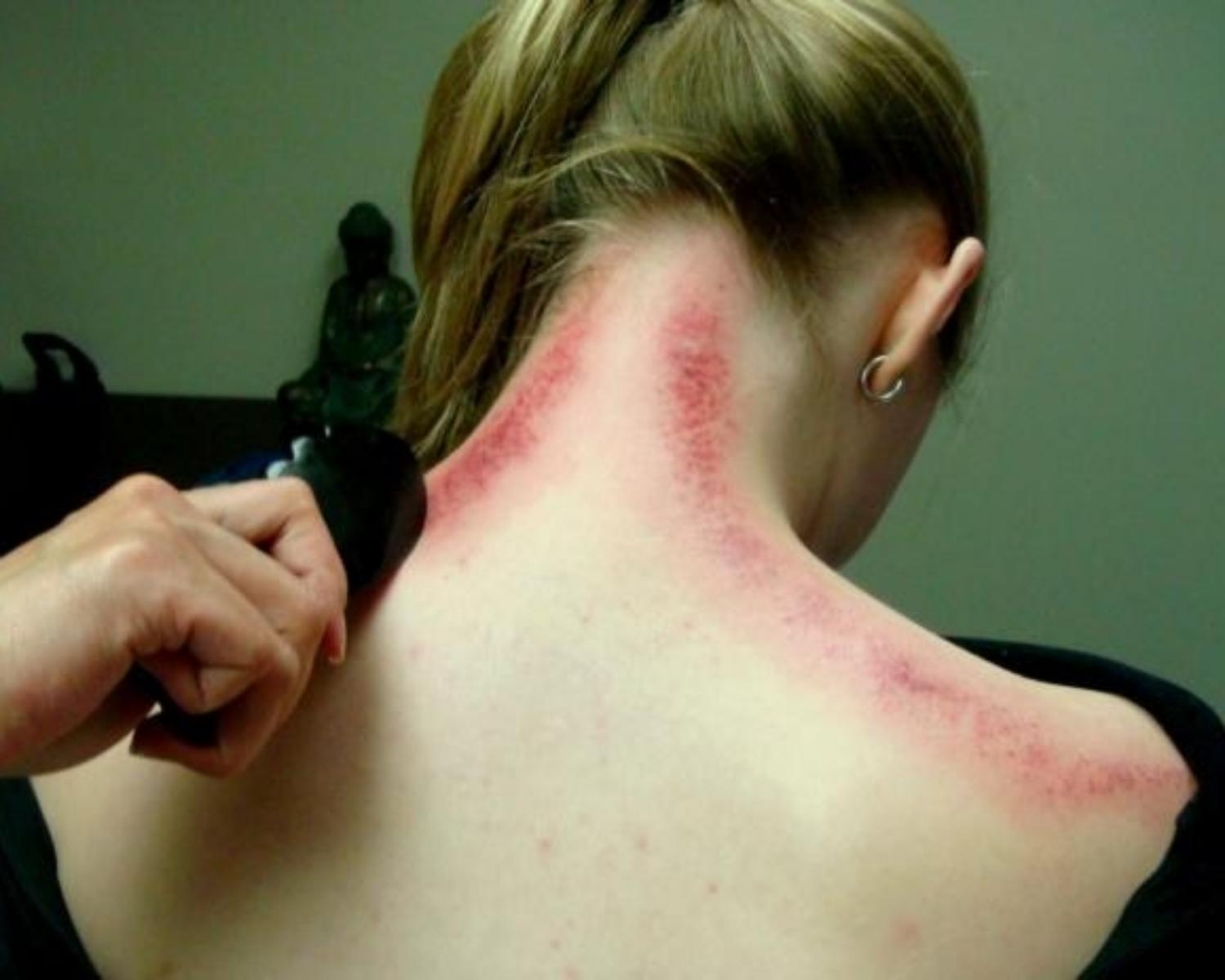 Gua Sha