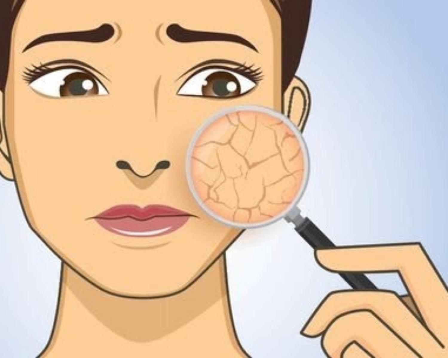 Dry Skin
