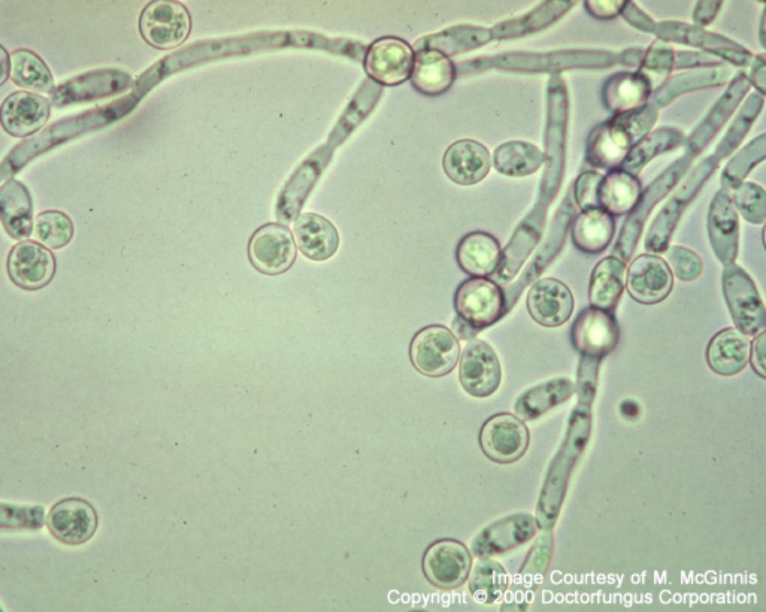 Why Yeast?? 
