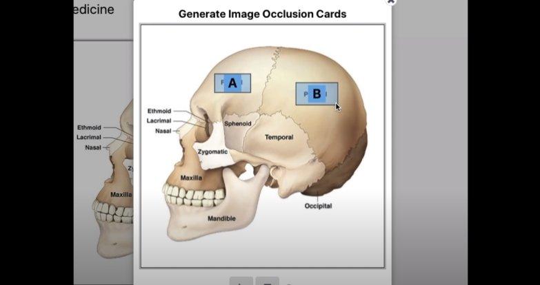 Memorization - 9). Occlusion