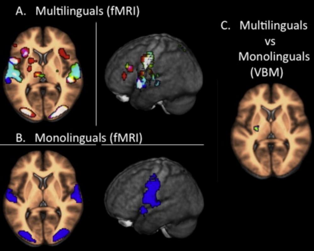 6. Changes in neurological processing