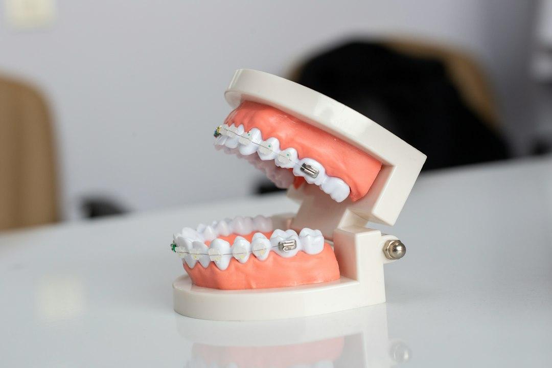Mouth Anatomy