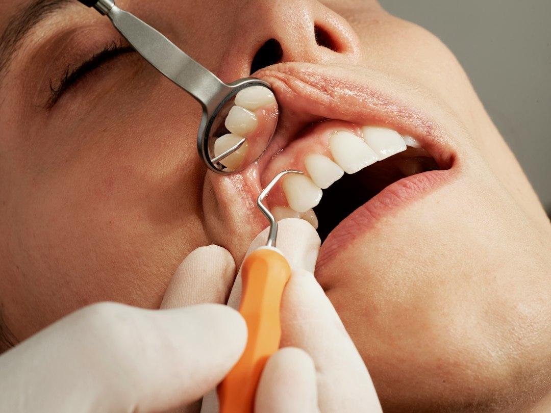 Cavities