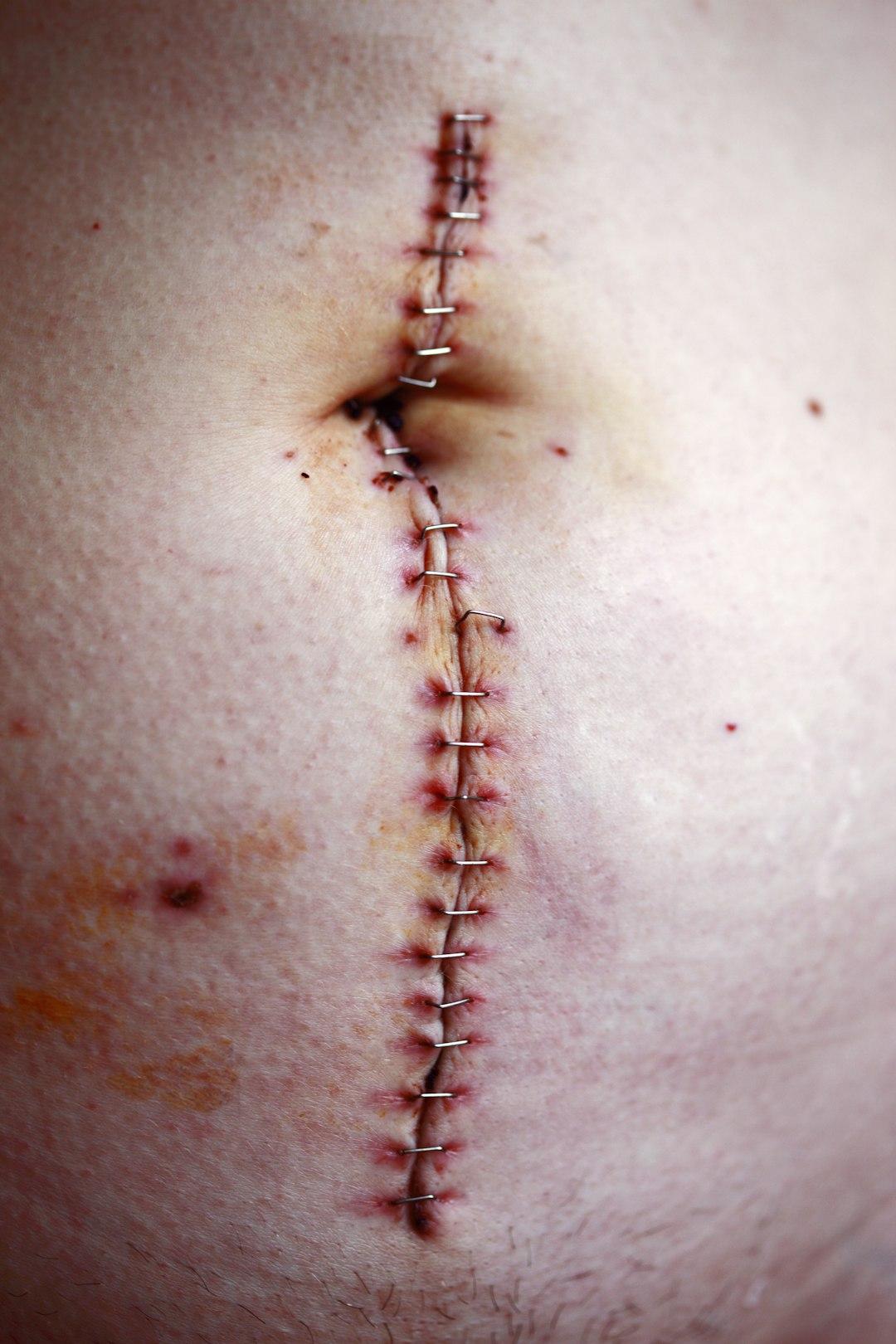 Do not hide your scars