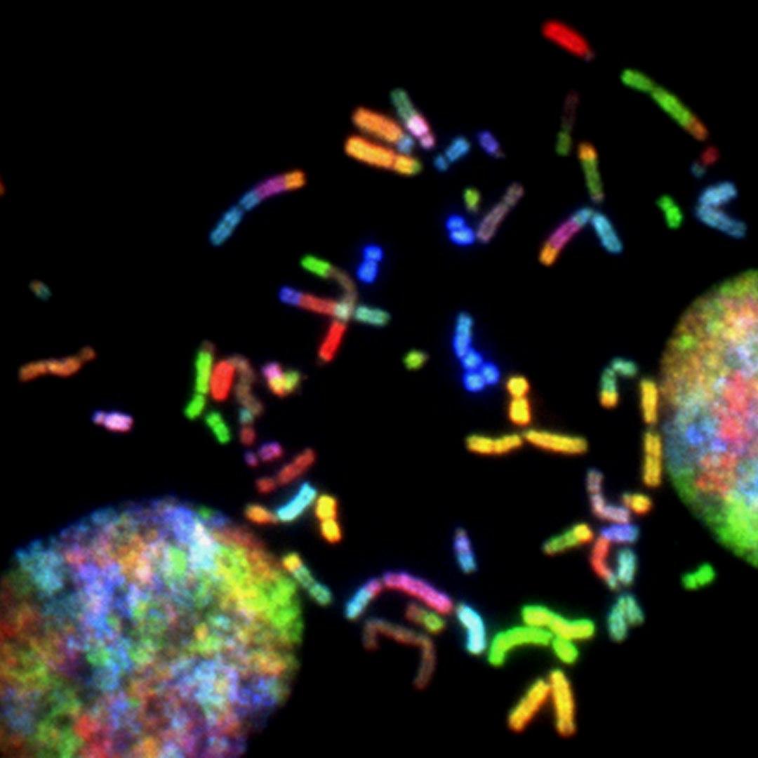 The Gut-Immune Connection