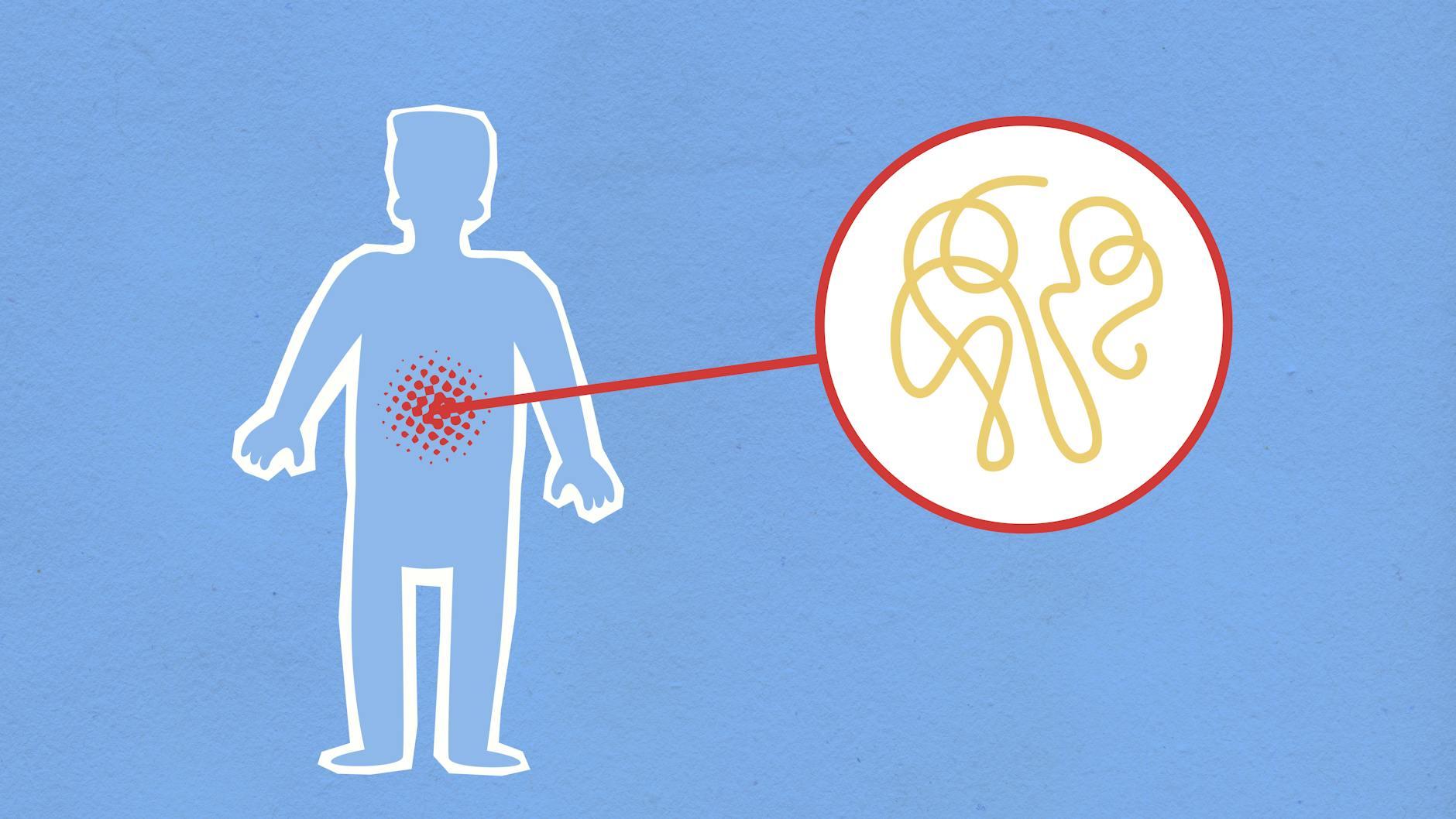 The Role of Inflammation